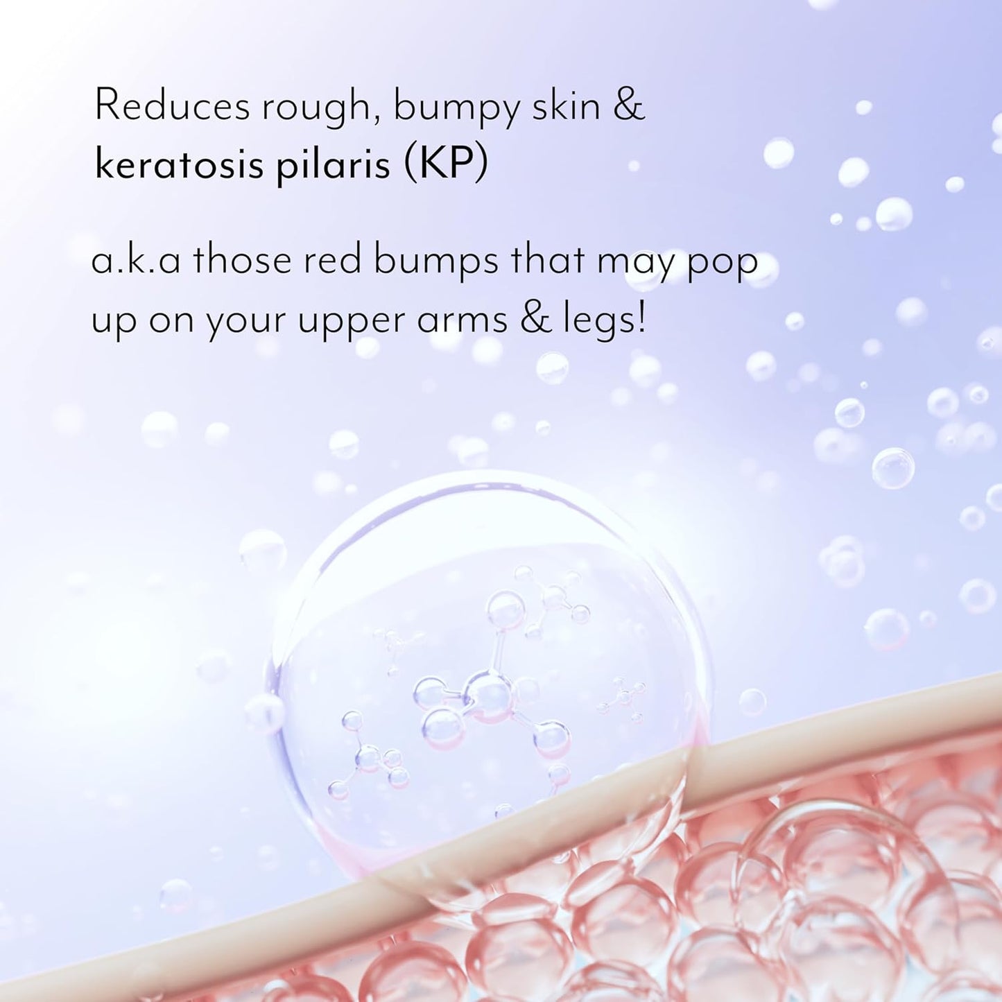 Bliss Body Butter Texture Takedown Skin Smoothing Lotion - Keratosis Pilaris KP - 6.7 Fl Oz - For Rough, Bumpy Skin - 10% AHA + Squalane + Shea Butter - Clean - Vegan & Cruelty-Free