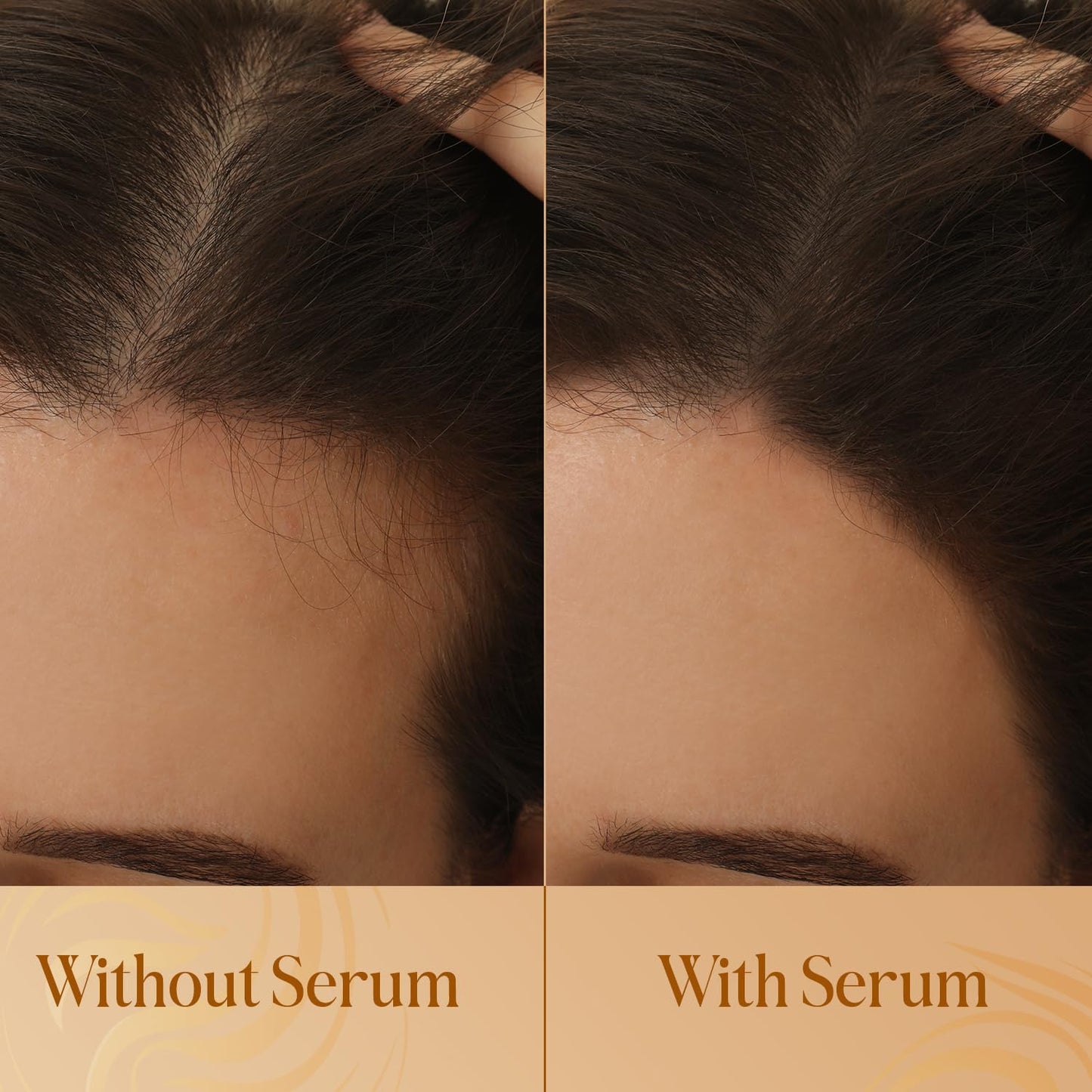 Revitalizing Scalp Serum for Hair Growth with Copper Peptides, Caffeine & Tea Tree Oil - Nourishing Scalp Oil for Itchy Dry Scalp, Detoxifies Build-Up, Deep Hydration for All Hair Types, 2 fl oz