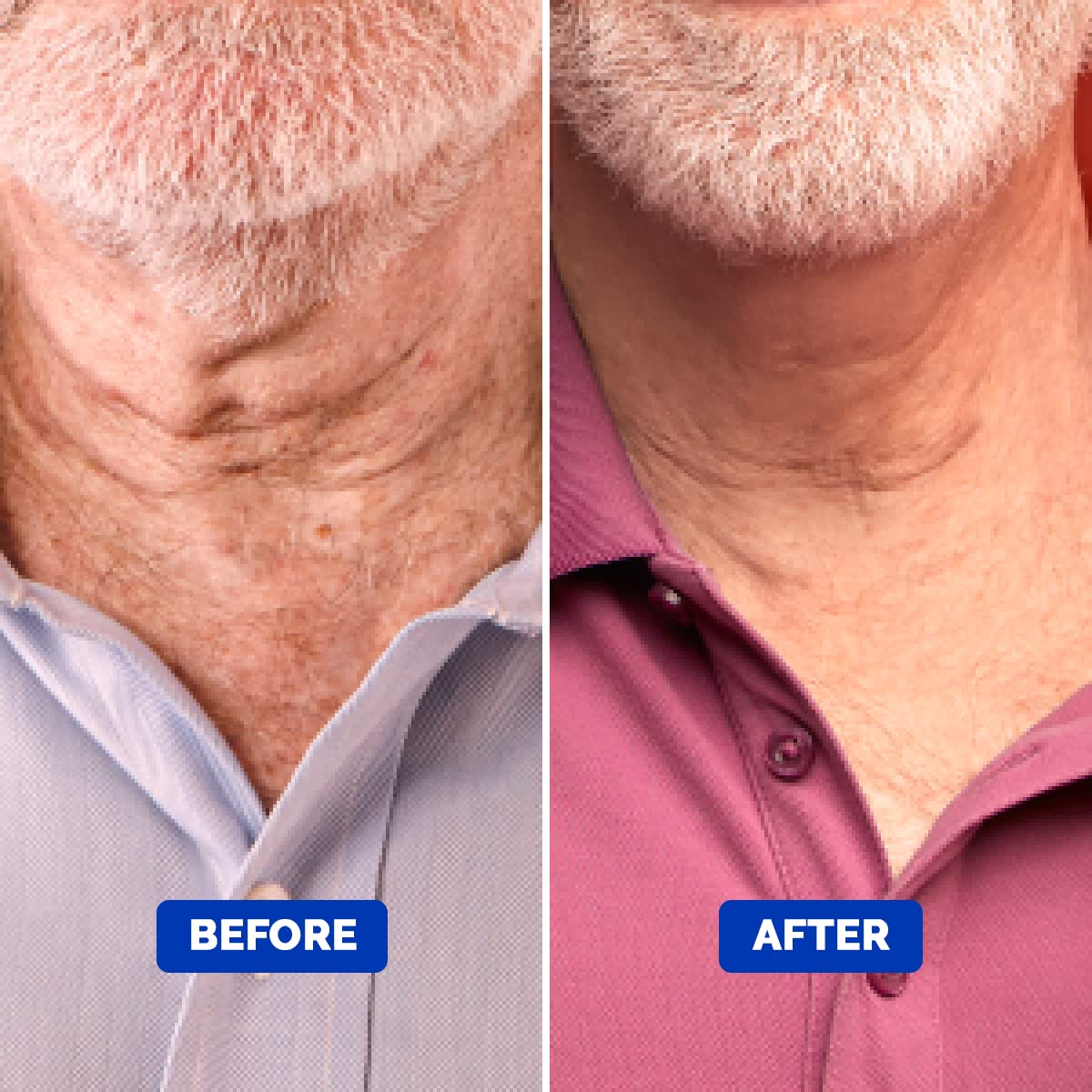 Particle Neck Cream for Men - Firming Cream, Lift and Moisturize The | Use on Saggy Skin or Turkey Anti Aging Triple Action with Collagen, Hyaluronic Acid, Retinol, 1 pack, 1.7 Fl Oz