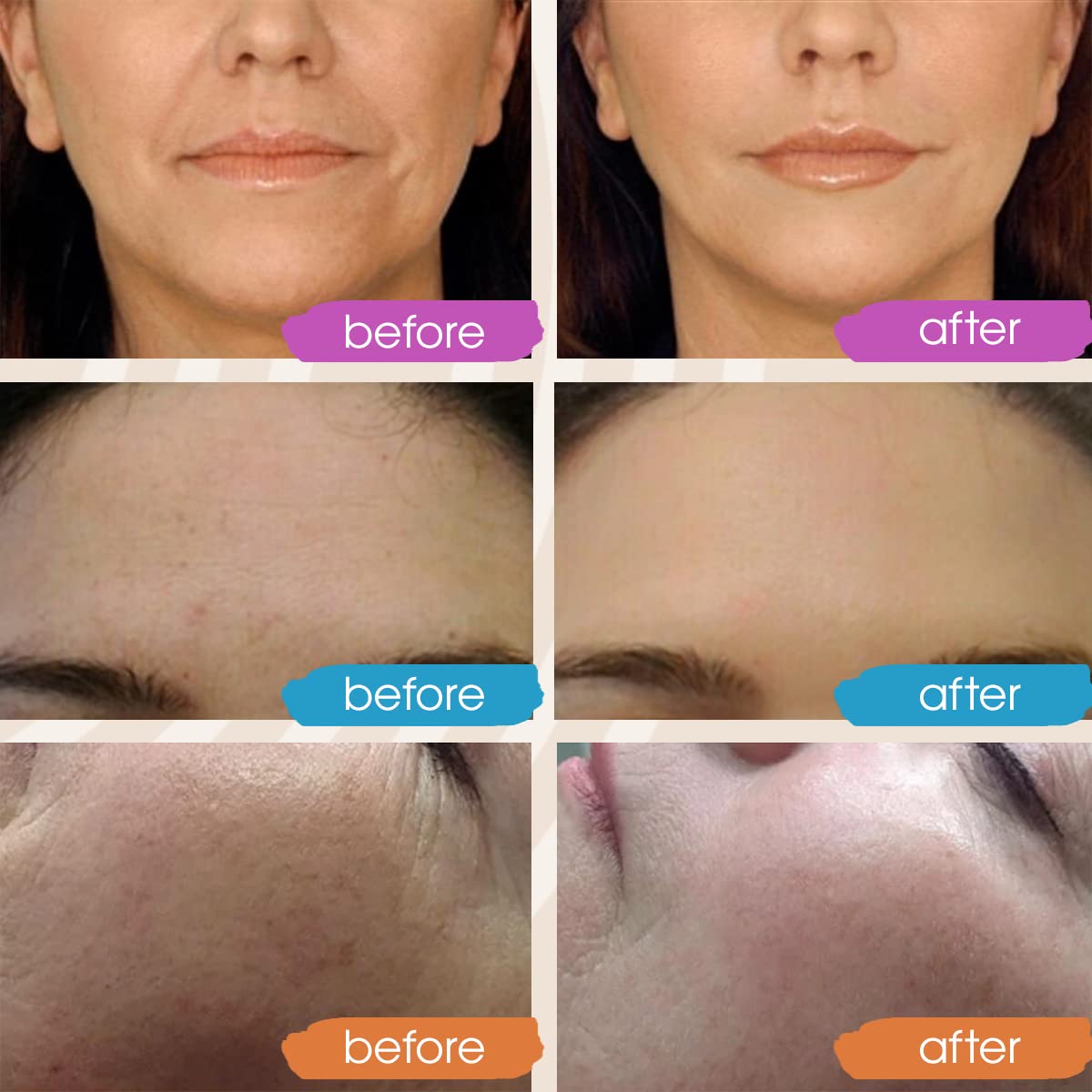 Retinol Serum for Face, Vitamin C with Hyaluronic Acid Face Serum for Women and Men, Glow Skin Care Set Total Package Targets Appearance of Uneven Skin Tone and Dryness 3x1oz