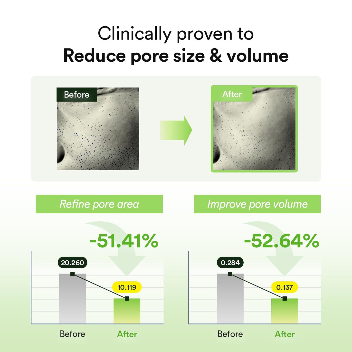 Abib Collagen Gel Mask Heartleaf Jelly 10 Sheets (Soothing) I Korean Vegan Collagen, Cooling Calming Hyaluronic Acid Hydrogel Face Mask Skin Care