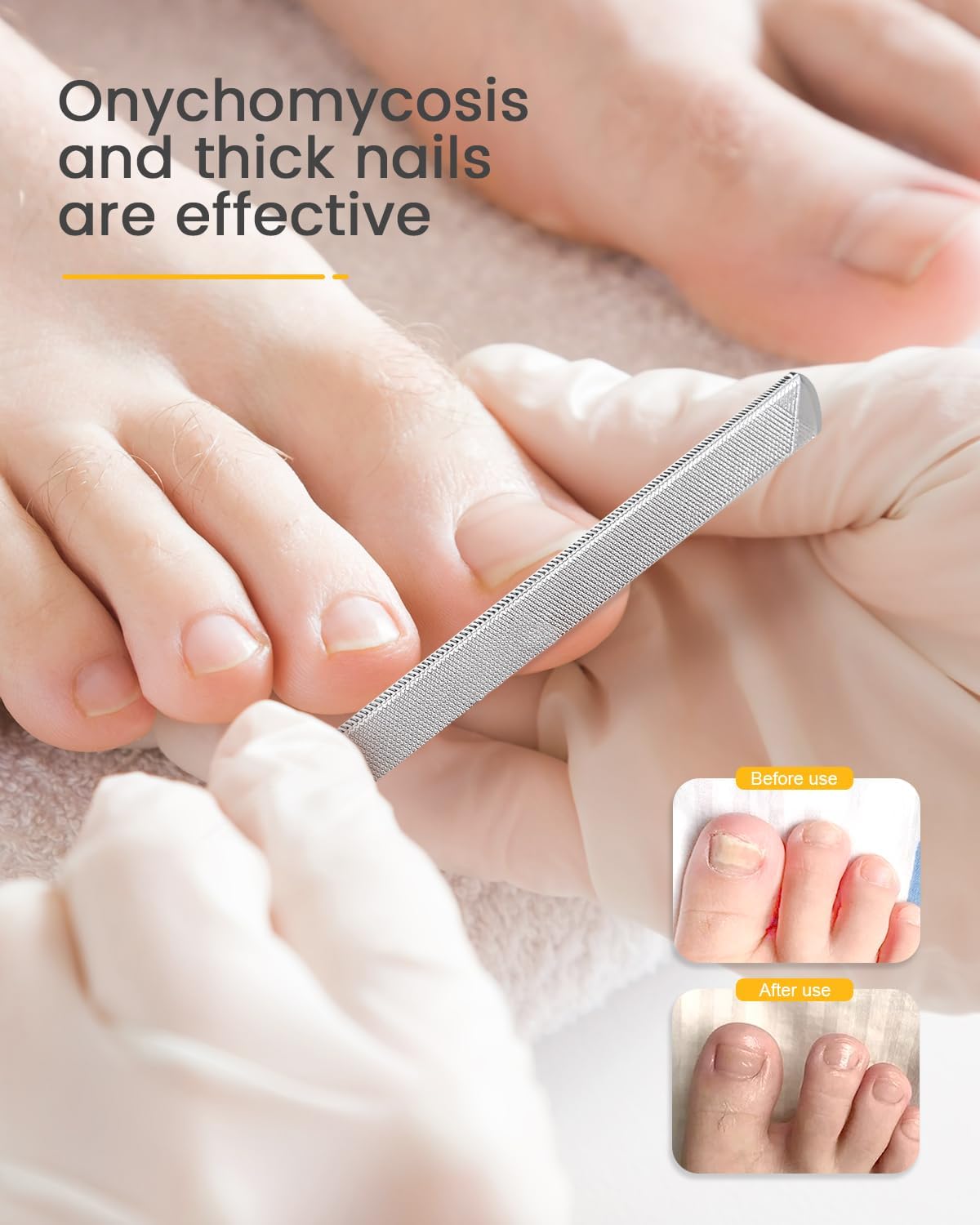 BEZOX Long Metal Nail File, Stainless Steel Fingernail File for Thick and Fungal Nails with Dual-Ended Toenail Lifter – The Ultimate Manicure & Pedicure Tool for Men and Women’s Nail Care - Silver