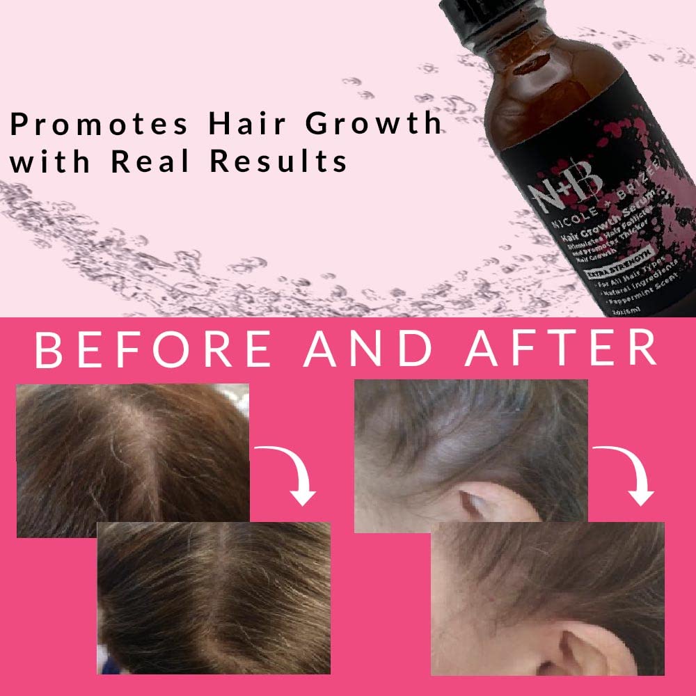 N+B Hair Growth Serum - Helps Promote Thicker, Fuller, & Healthier Hair w/Biotin, Natural-Based Formula, Helps Prevent Hair Fall & Thinning, For Women In All Hair Types - 2oz.