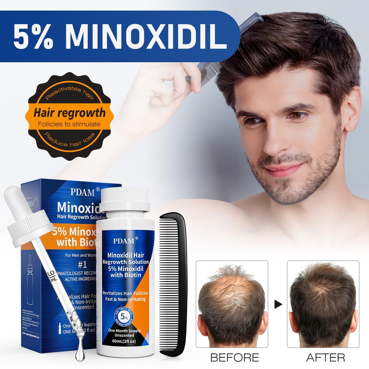 5% Minoxidil for Men Hair & Beard Growth Kit, Minoxidil for Women Hair Growth Serum, Extra Strength Hair Loss Treatment for Thinning Hair, Promotes Thicker Fuller Regrowth, Nourishes Scalp, 3 × 2oz