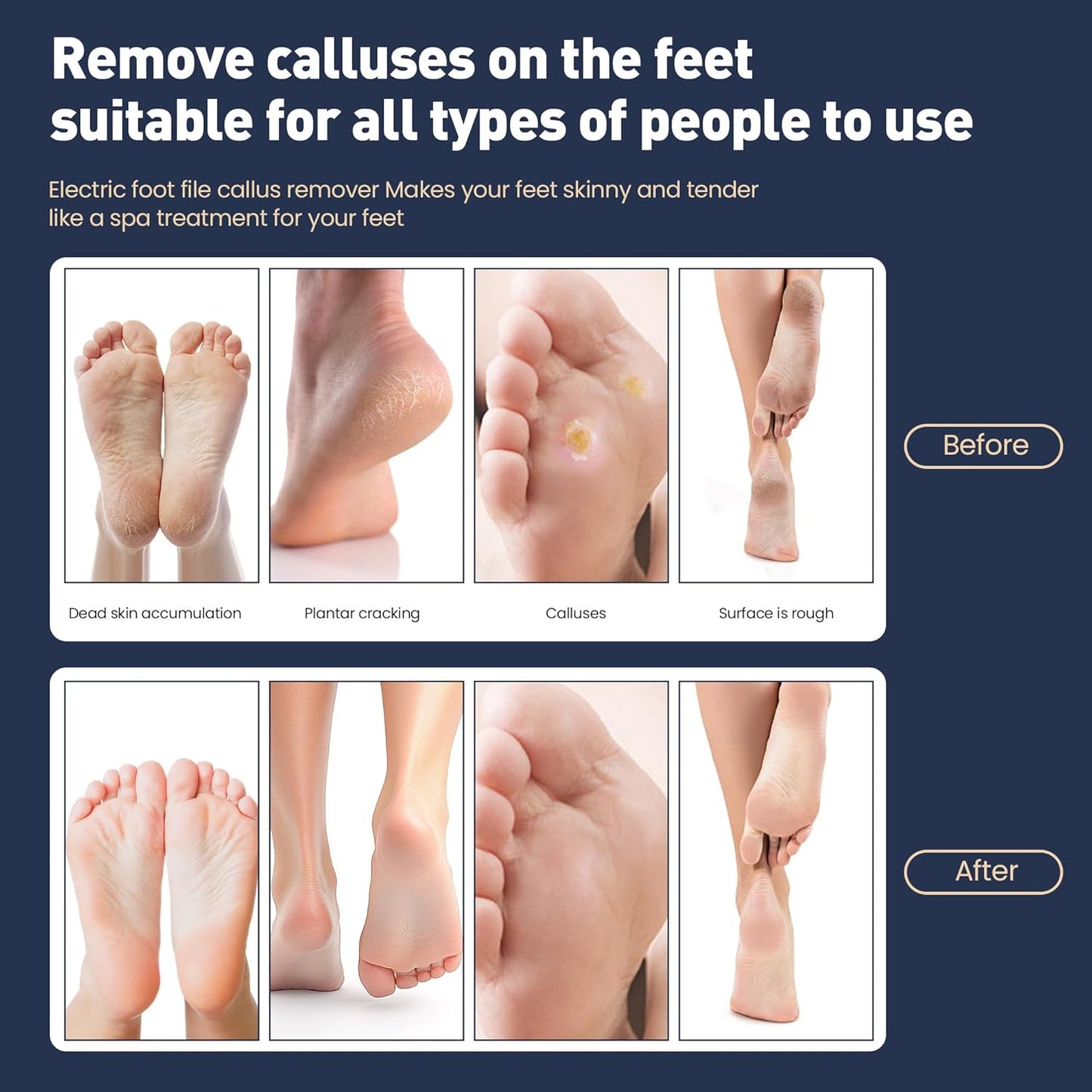 Electric Foot Callus Remover,2 in1 Rechargeable Callus Remover for Feet,9-Speed Wireless Electric Foot File Nail Grinder,Foot Scrubber Pedicure Tools for Dead Skin Dry Cracked Feet (Gold MINI)