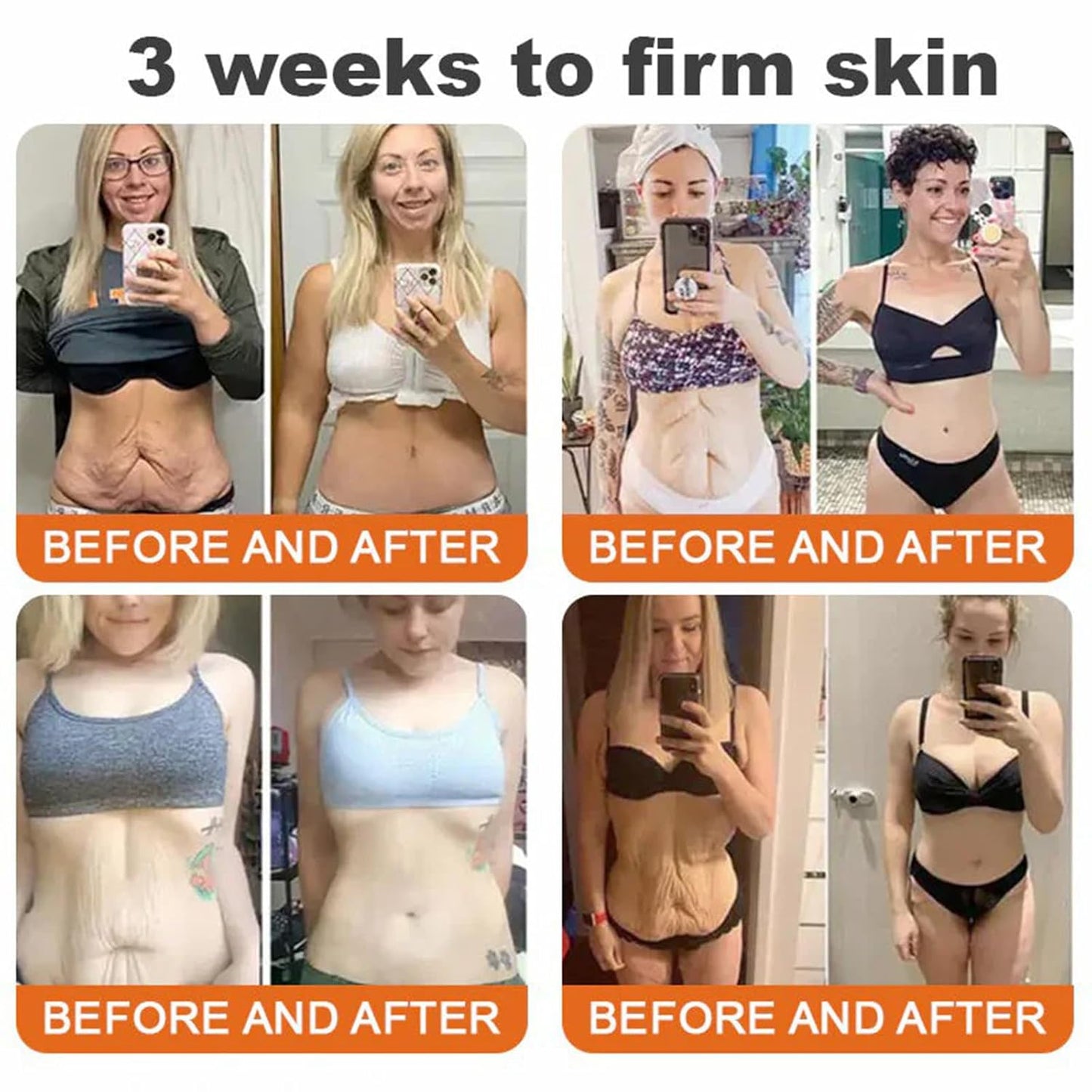 Bee Venom Comprehensive Cream, Professional bee venom cream for Removing and Repair, APKAPK Bee Venom Skin Treatment Cream, Natural Serum Suitable for All Skin Types (4 Pack)