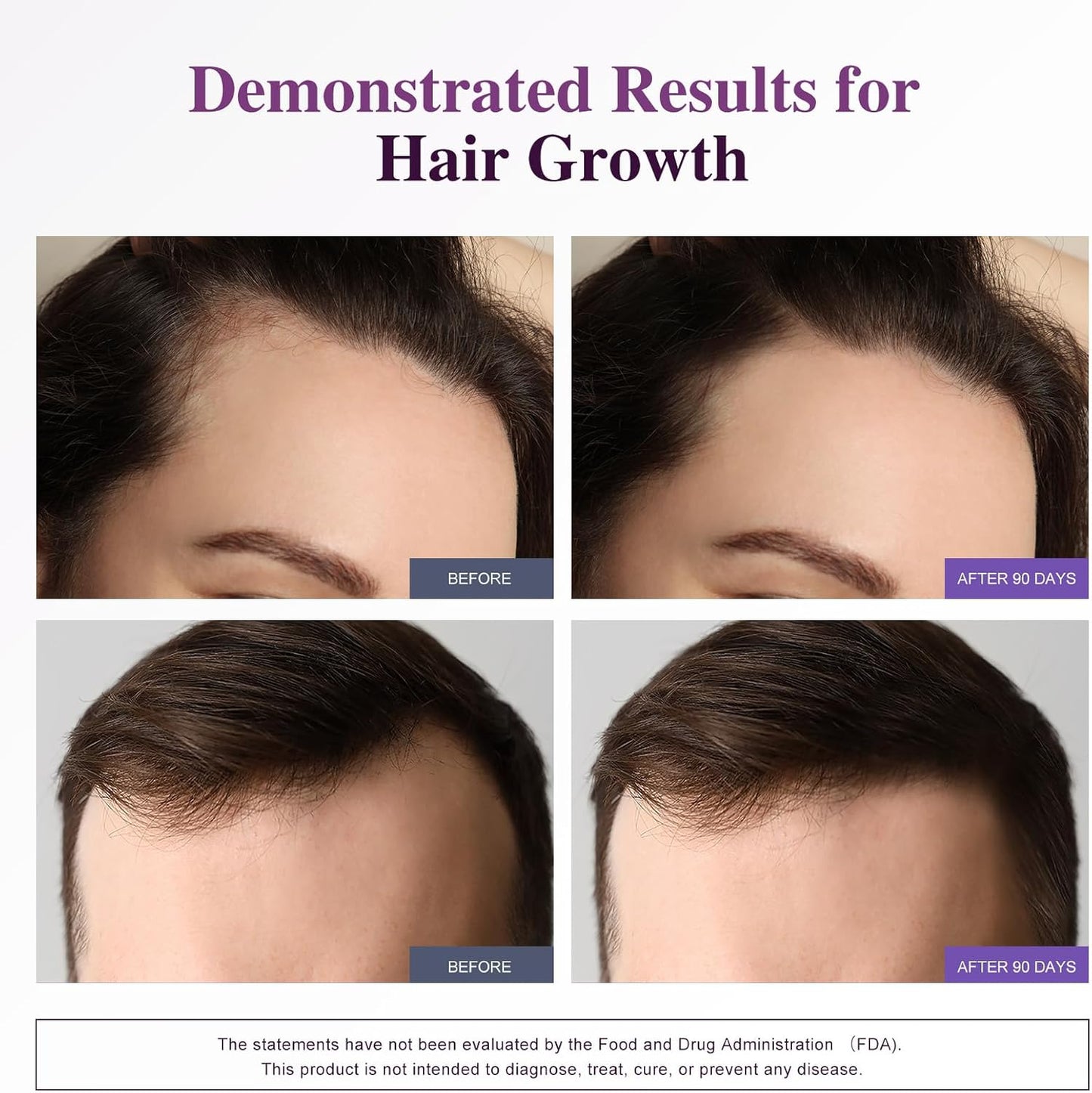 Biotin 10,000MCG Hair Growth Support for Women & Men with Collagen & Keratin – Hair, Skin & Nails Vitamins with Multivitamins & Minerals – 120 Capsules (2-Month Supply)