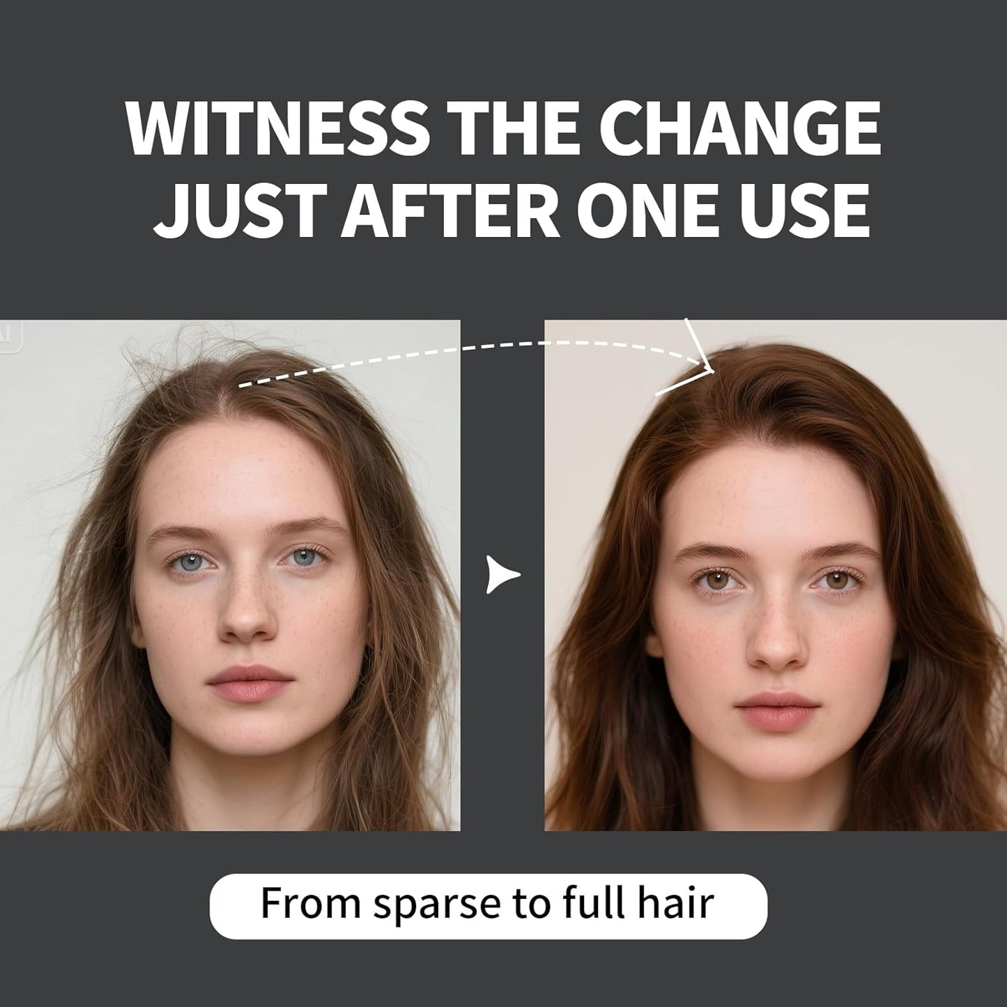 Hair Building Fibers Refill Pack - 100g Instant Thickening Fibers for Men & Women, Natural Cotton Powder, Wind/Rain Resistant, For All Hair Fiber Applicator Bottles (Medium brown)