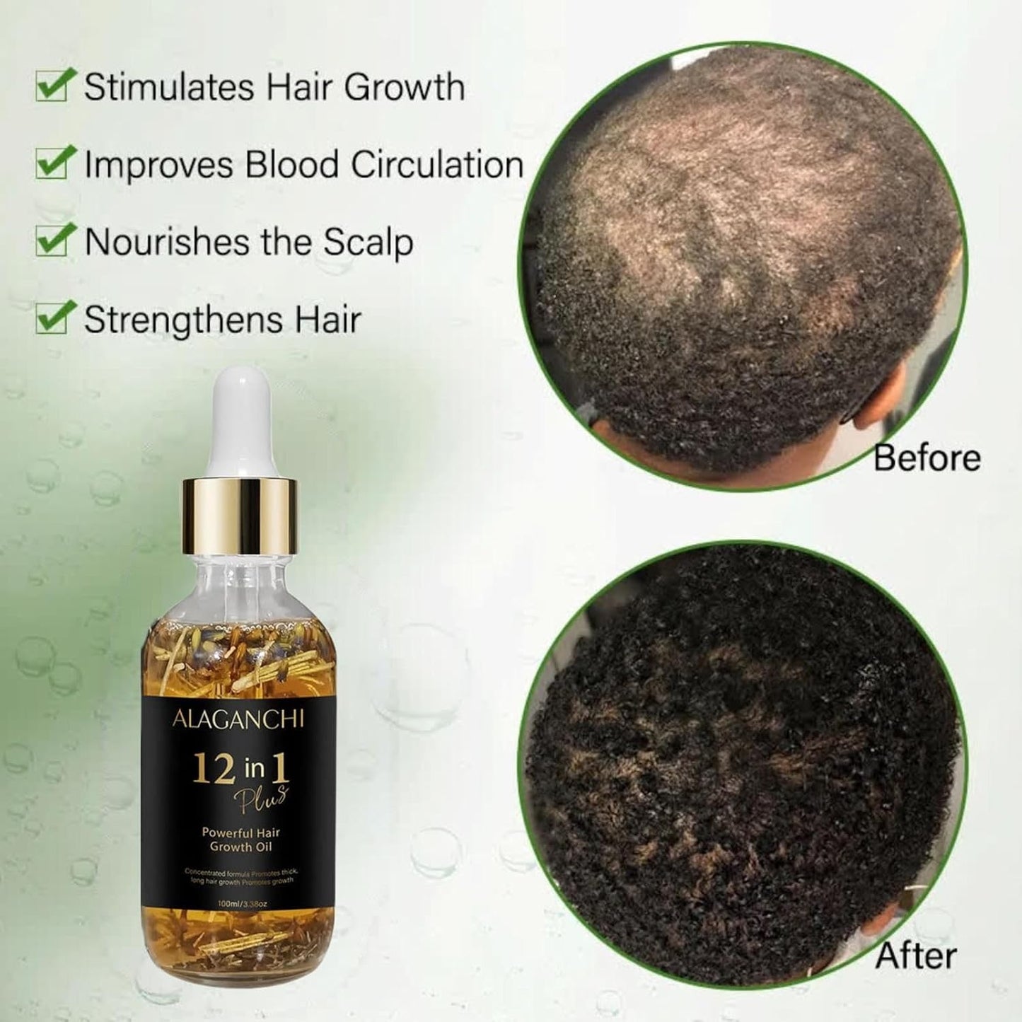 12-in-1 Hair Growth Oil – Rosemary, Amla & Castor Oil | Strengthens, Nourishes, Reduces Hair Fall | Natural Herbal Blend | Non-Greasy | Paraben & Sulfate-Free
