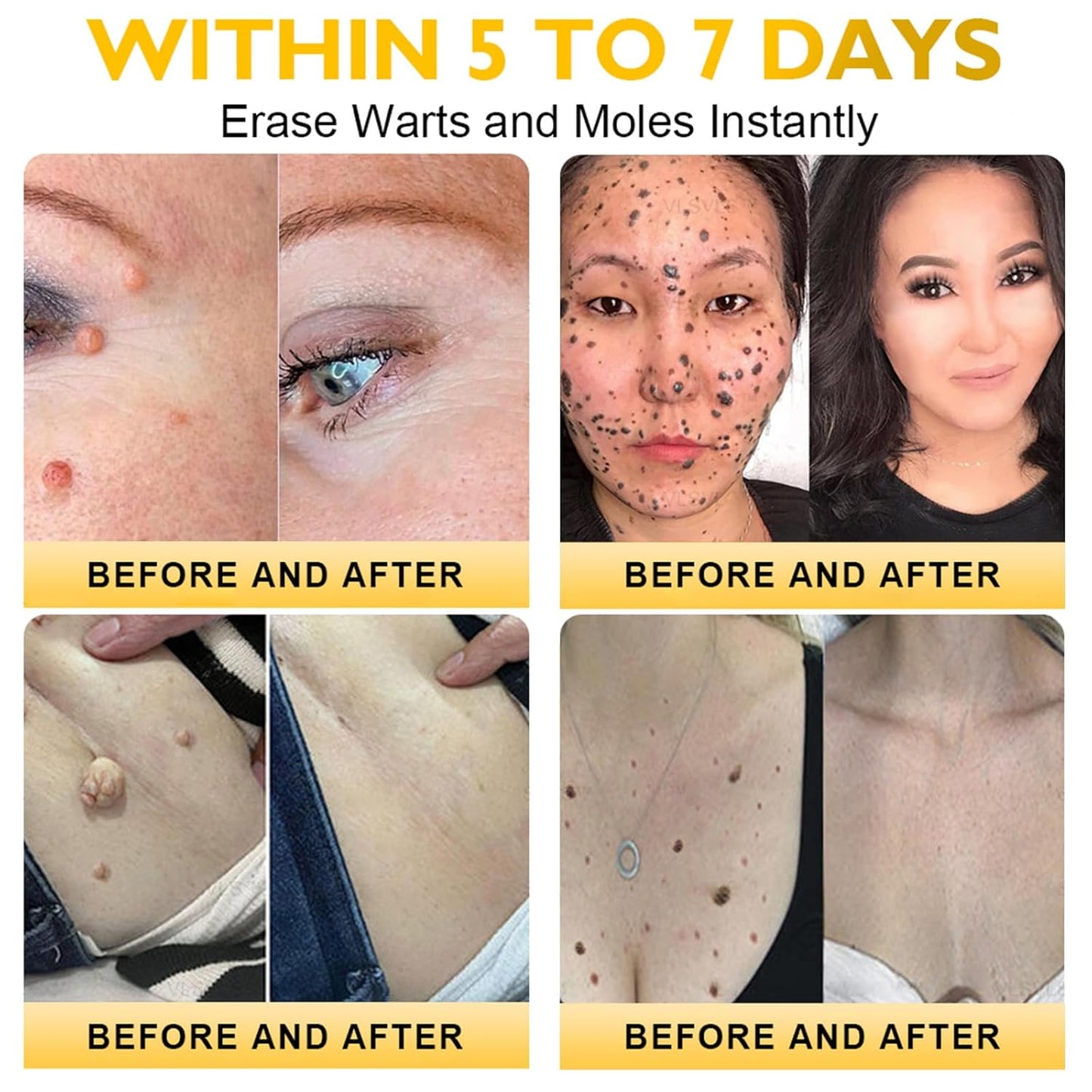 LipMaps Bee Venom skin Restoration Cream,Bee Venom Skin Treatment Cream,Deeply Moisturizing and Firming for All skin Types(3PCS)