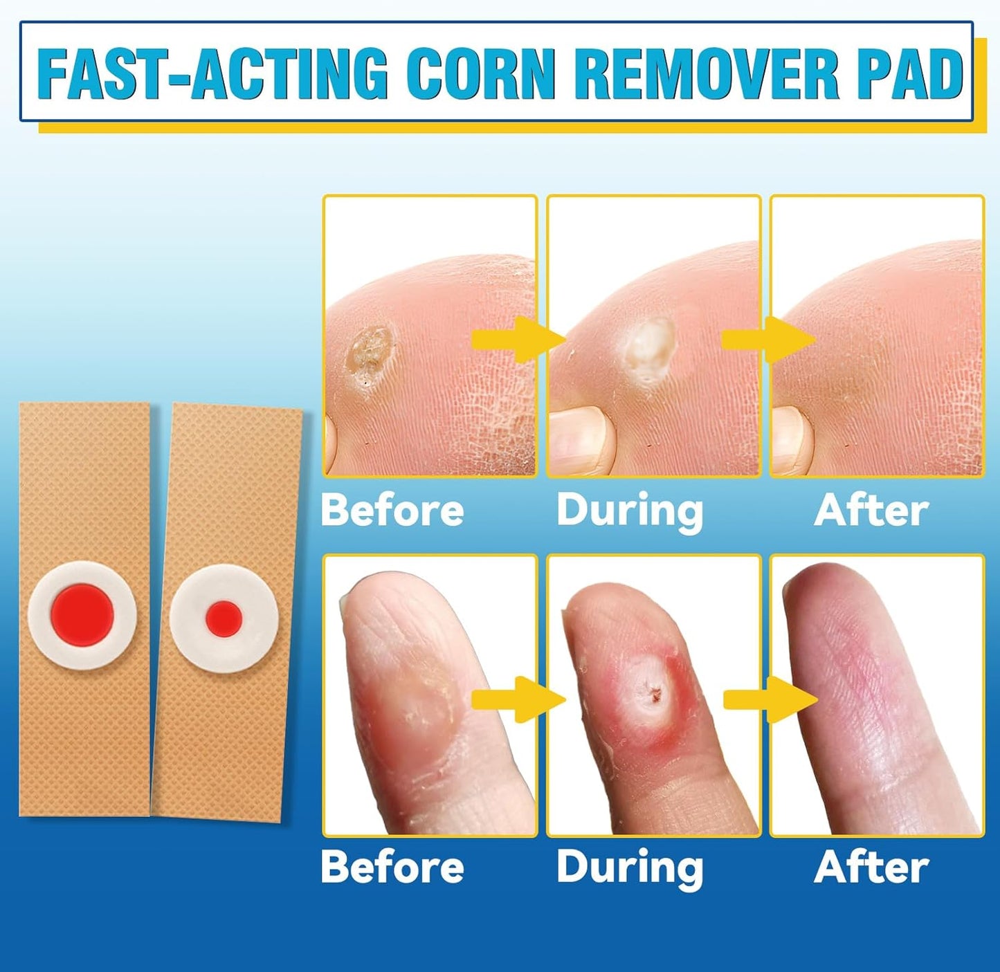 Corn Removers for Toes, Feet, 24 Packs Corn Pads for Toes with 12 Large Size and 12 Small Size, Gentle and Safe Corn Callus Remover Cushions Stick to Keep Your Skin Healthy, Relieve Corn Pain