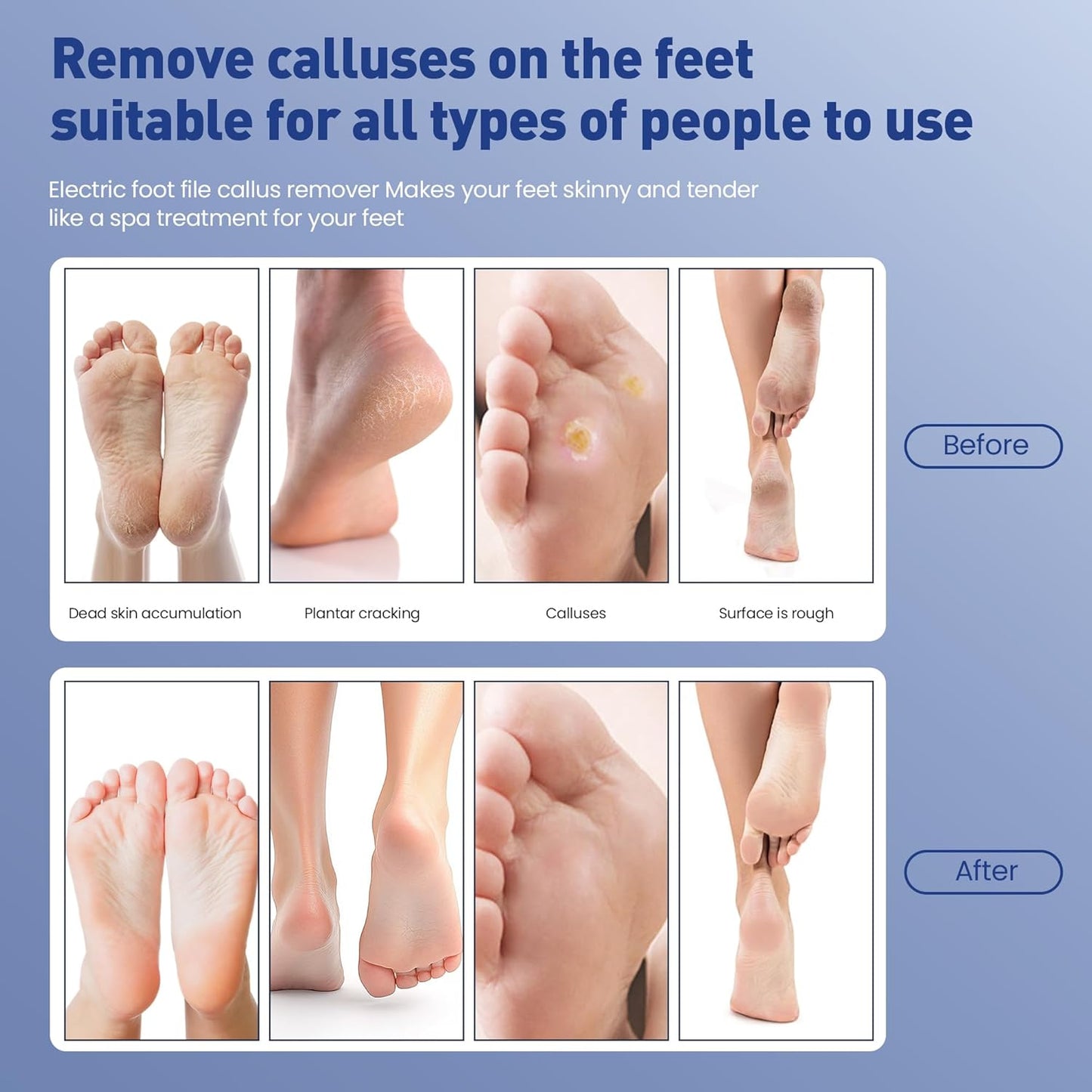 Electric Foot Callus Remover,2 in1 Rechargeable Callus Remover for Feet,9-Speed Wireless Electric Foot File Nail Grinder,Foot Scrubber Pedicure Tools for Dead Skin Dry Cracked Feet (Black Fold)