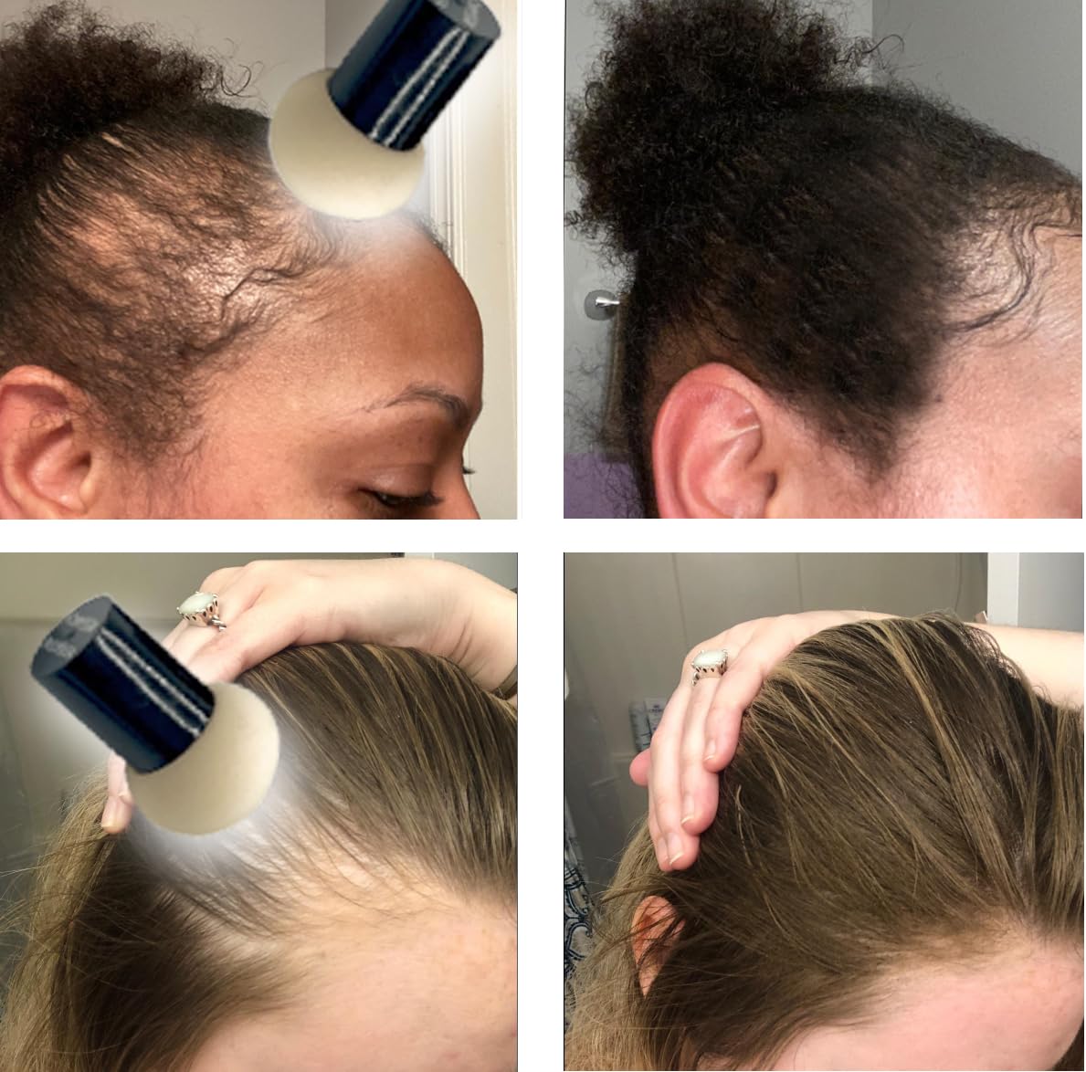 KERATIN RESEARCH Hairline Filler Unisex Mineral Powder Root Touch-Up Hair loss Concealer Scalp & Beard Bald Patch Coverage Fibers for Thinning Hair Waterproof Organic Natural look (AUBURN, XL)