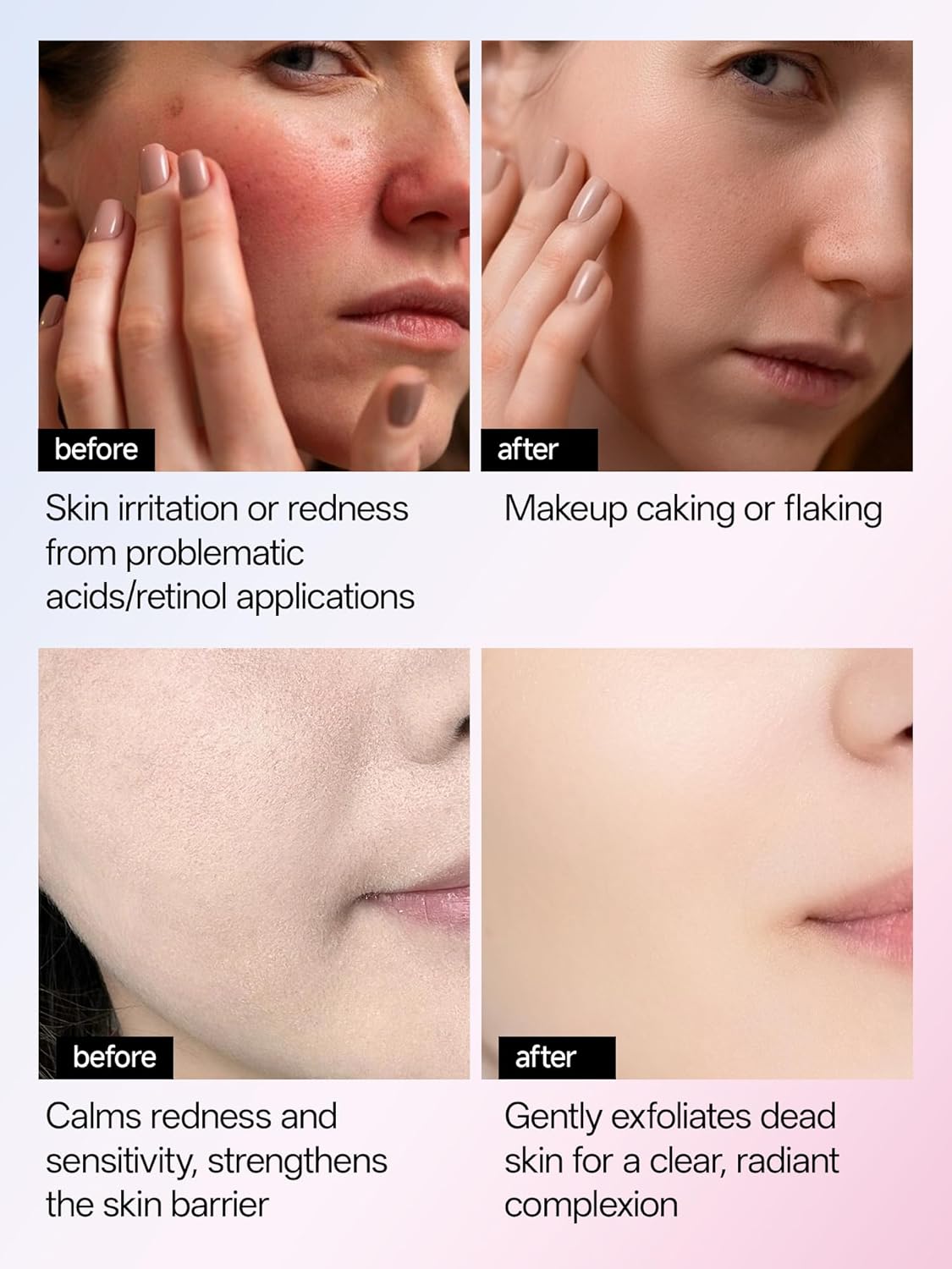 WNP 6D Bionic Collagen Bio‑Gel Mask Hydrating Overnight Real Deep with 5.1% Collagen, Niacinamide, Hyaluronic Acid|Firming, Anti‑Aging, Brightening for sensitive skin 28g x4ea