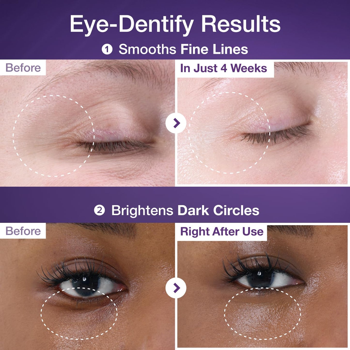 numbuzin No.9 Eye Cream | NAD+ Retinol Volumetox Eye Cream | Firming, Wrinkles, Fine Lines, Dark Circles, Puffy | Retinol, Peptides, Niacinamide | Undereye Treatment Serum | 0.33 fl. oz.