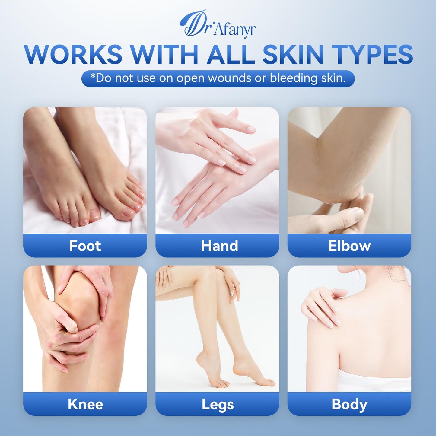 40% Urea Cream for Feet – Foot Cream for Dry Cracked Rough Heels, Urea 40 percent Foot Lotion for Moisturizing Skin, with 2% Salicylic Acid for Callus Remover & Repair (5.29oz)