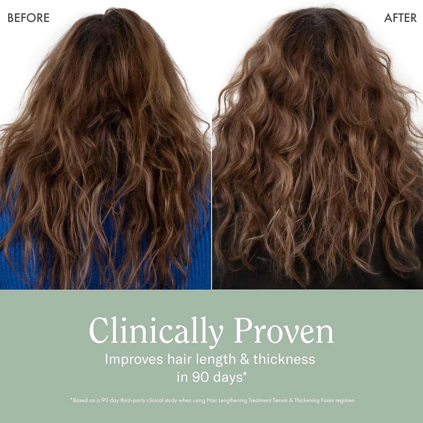 Rizos Curls Hair Lengthening Treatment Serum, Fortifies At Root for Healthy Scalp Microbiome Promoting Length, Supportes Longer Stronger Hair, 4.2 oz