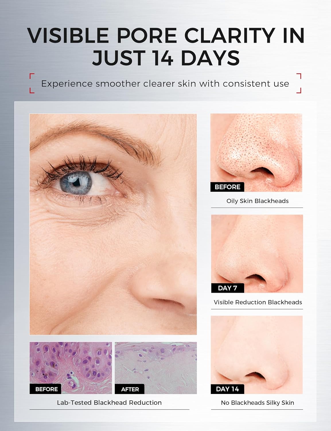 Tembusu Essence Clay Mask for Sensitive Skin: Triple Mud Formula with Tembusu Extract, Deep Pore Cleanser, Hydrating, Oil Control, Texture Refining, Blackhead Removal – 3.88 Oz