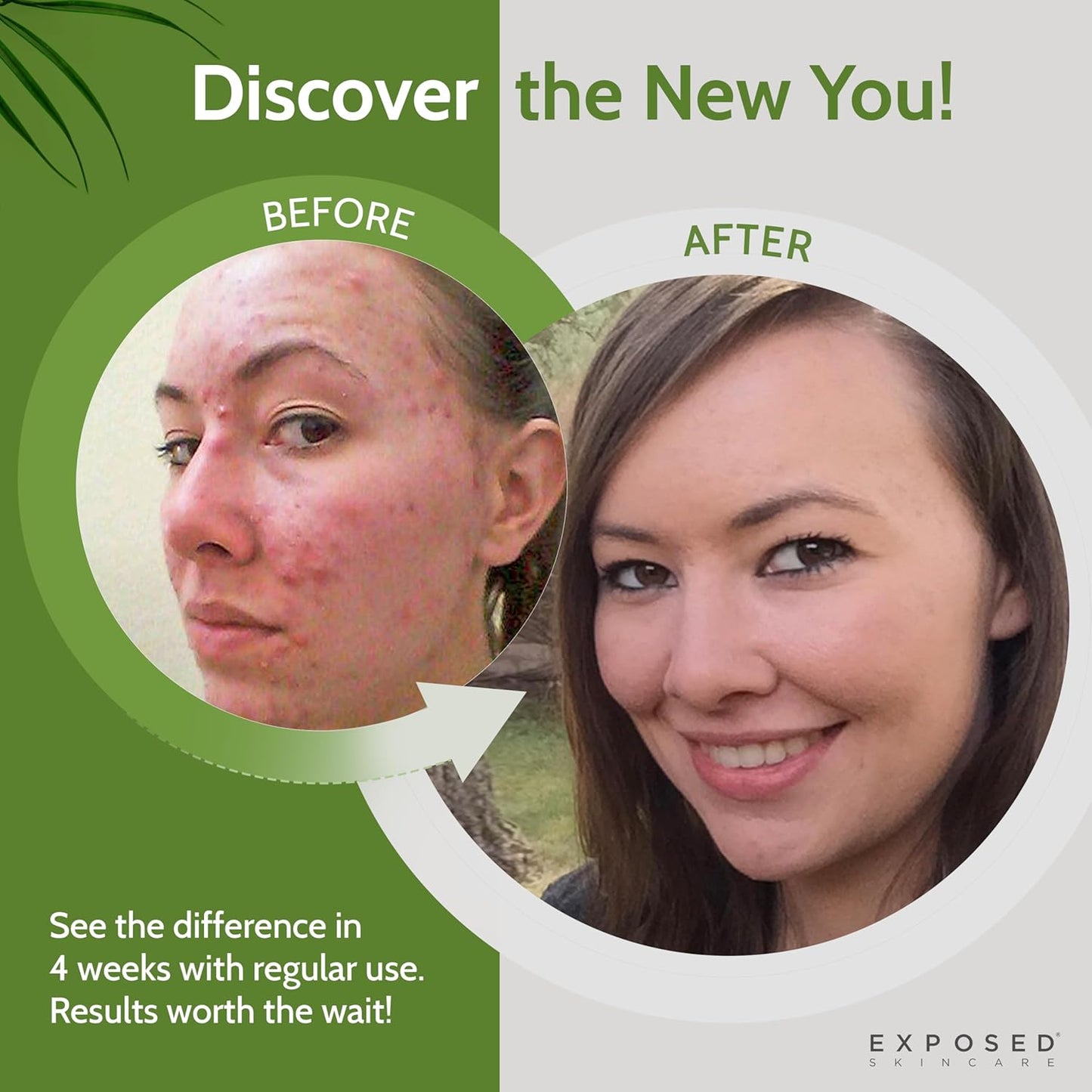 Exposed Skin Care Acne Facial Cleanser – Gentle Salicylic Acid Face Wash for Acne-Prone Skin – Pore Clarifying Wash for Teens & Adults, All Skin Type