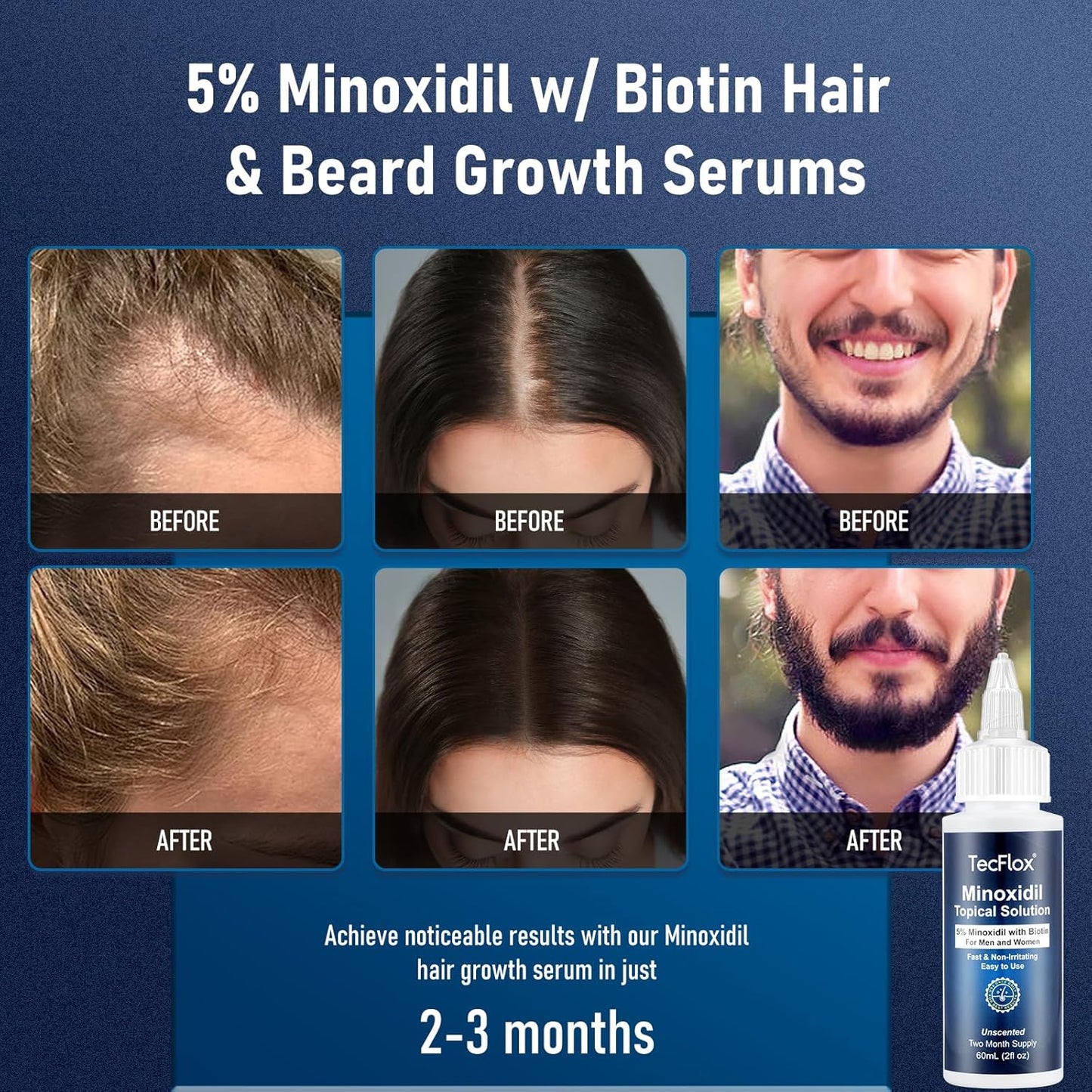 5% Minoxidil for Men Hair with Biotin, Minoxidil for Women,Tecflox Minoxidil Beard Growth Oil, Minoxidil Hair Growth Serum for Men,4-Pack,Total 8Fl Oz for 8 Months, Hair Growth Oil(White)
