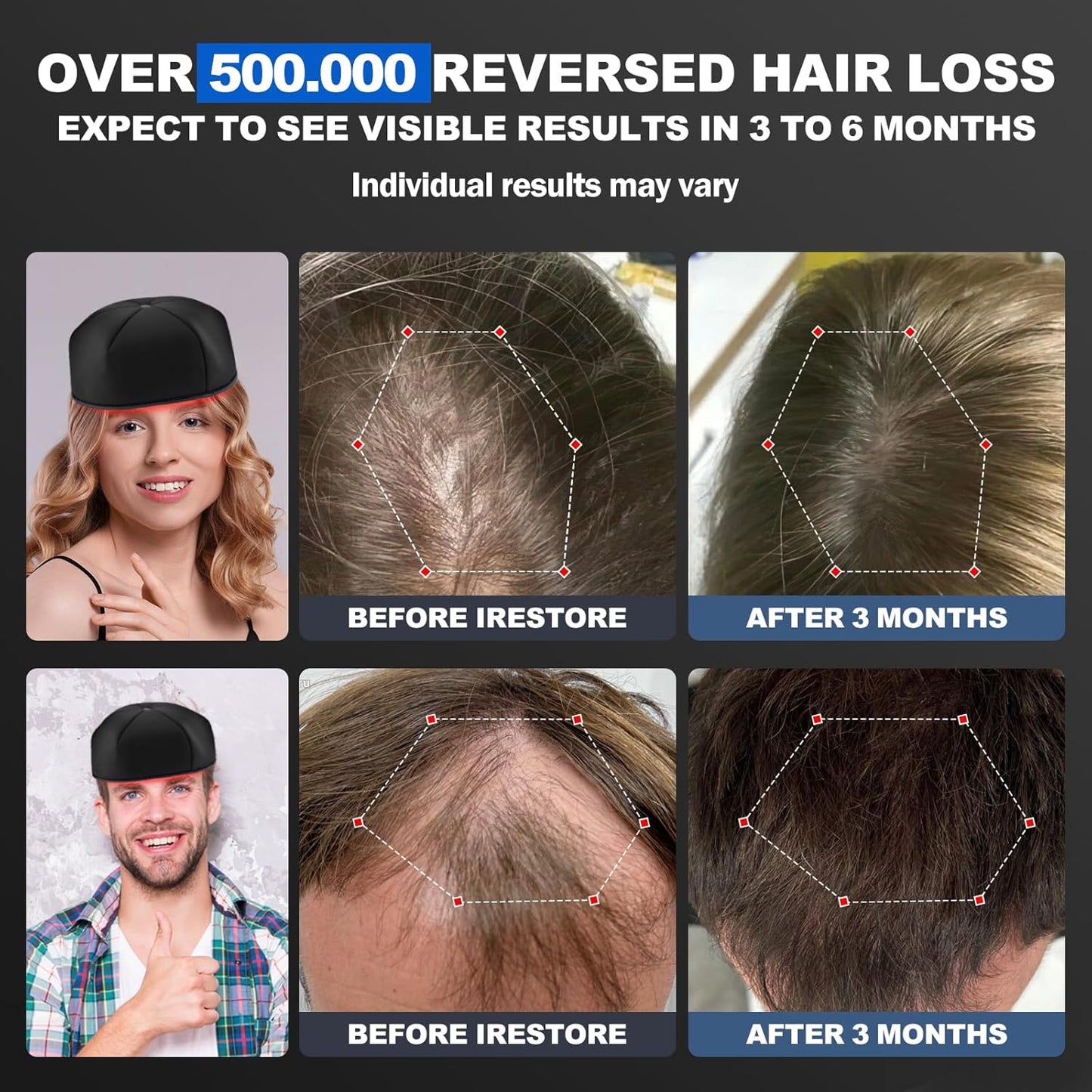 Laser Cap, FDA Cleared Laser Hair Growth Cap, Red Light Therapy promote hair growth in women and men