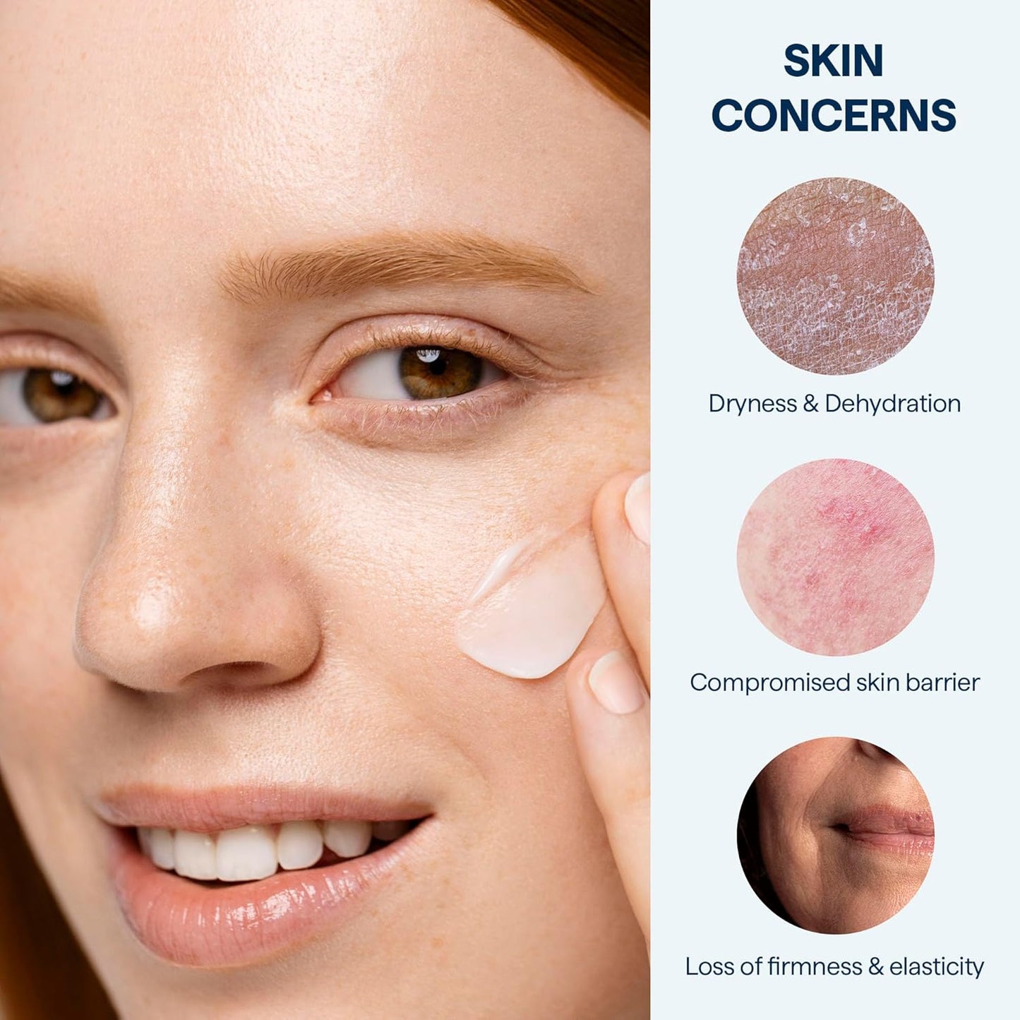 Remedy for Rich Moisture - Barrier Repairing Rich Cream Moisturizer for Normal to Dry Skin - Quadruple Ceramide Complex, Peptides, Squalane, Glycerin- By Dermatologist Dr. Shah, 1.7 fl. oz