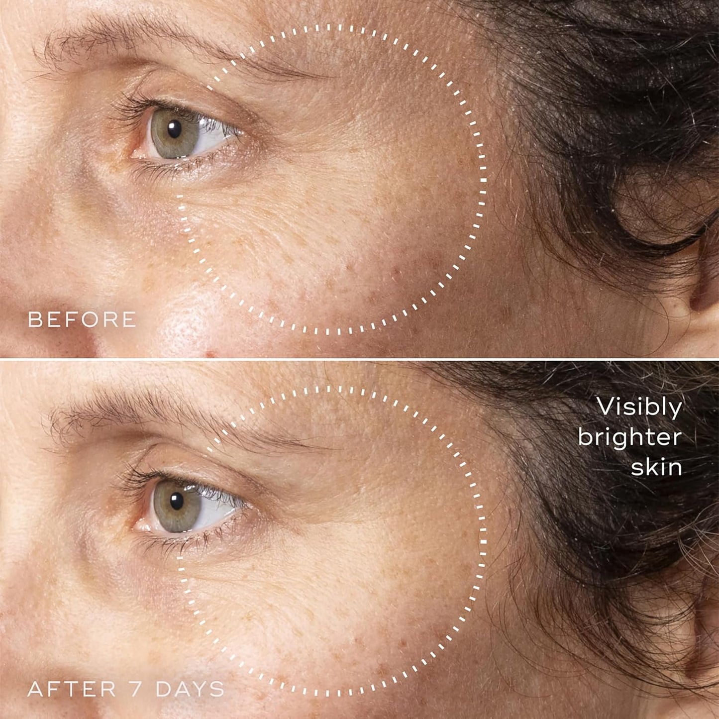 Medik8 C-Tetra Advanced - Balancing, Plumping, Hydrating Daily Vitamin C Serum with Hyaluronic Acid, Squalene - Smooths Fine Lines, Wrinkles - 1.0 oz