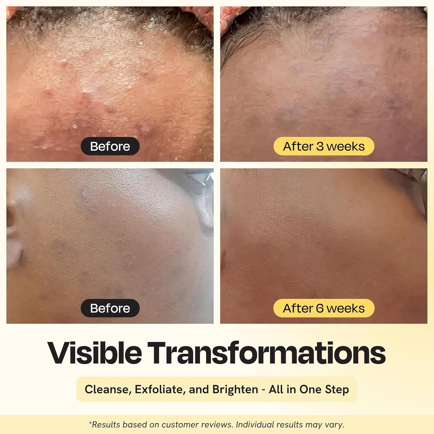 Gleamin Vitamin C Face Wash & Facial Cleanser - Cream to Foam 2% Salicylic Acid Cleanser with Paw Paw & Turmeric - Gentle Exfoliating Facewash for Women & Men, Oily & Combination Skin, 3.4 fl oz