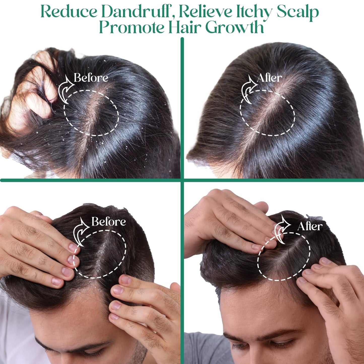 JSK Hair Growth Shampoo & Conditioner Set Biotin & Rosemary for Thinning Hair, DHT Blockers, Hair Care Kit for Men & Women, Includes Scalp Massager & Bonnet, Sulphate-Free Thickening & Moisturizing