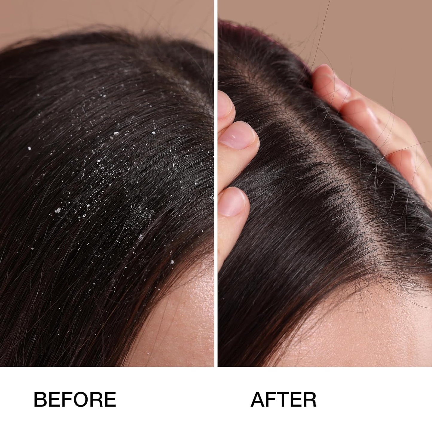 GK HAIR Anti-Dandruff Shampoo Feel the Relief as Itching and Flakes Fade Away, Leaving Your Scalp Refreshed and Hair Soft, Smooth, and Full of Life – Sulfate-Free, 8.5 Fl Oz