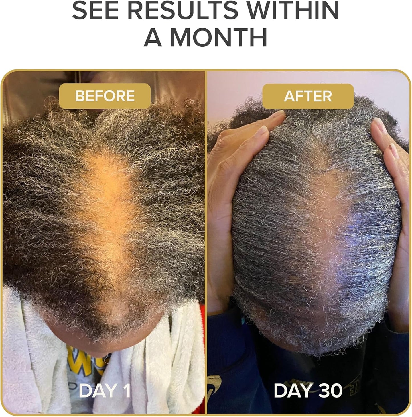 Iconic Natural Hair Vitamins for Fast Hair Growth, Pure Hair Supplements Formulated with Vitamins to Promote Thicker, Stronger Hair - Vegan Hair Care for Hair Loss - (60 Capsules(Pack of 1))